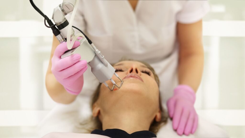Q Switched Laser for Pigmentation