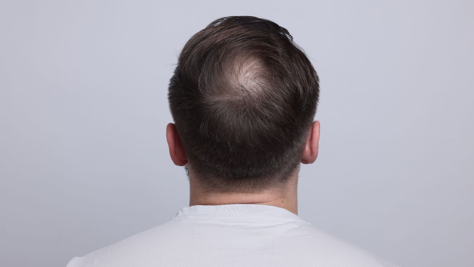 Side Effects of DHT Blocker