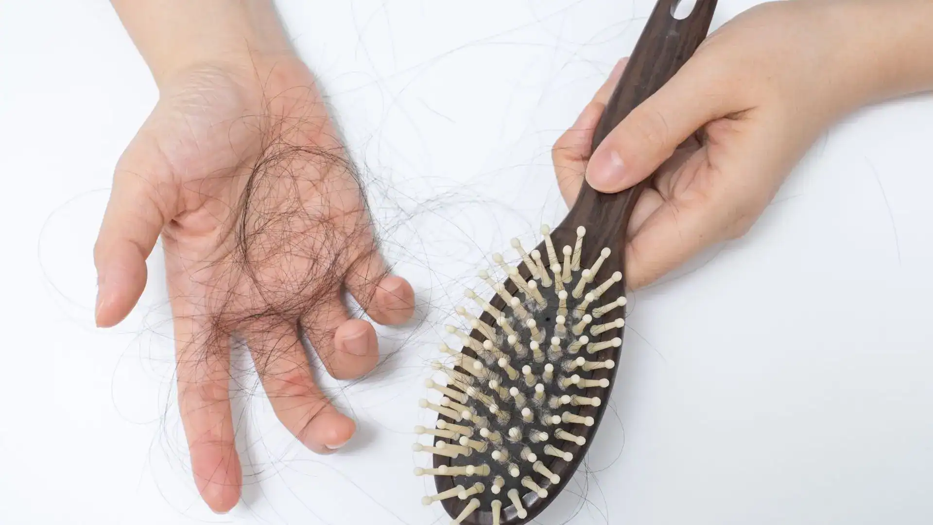 PCOS Hair Loss in Chennai