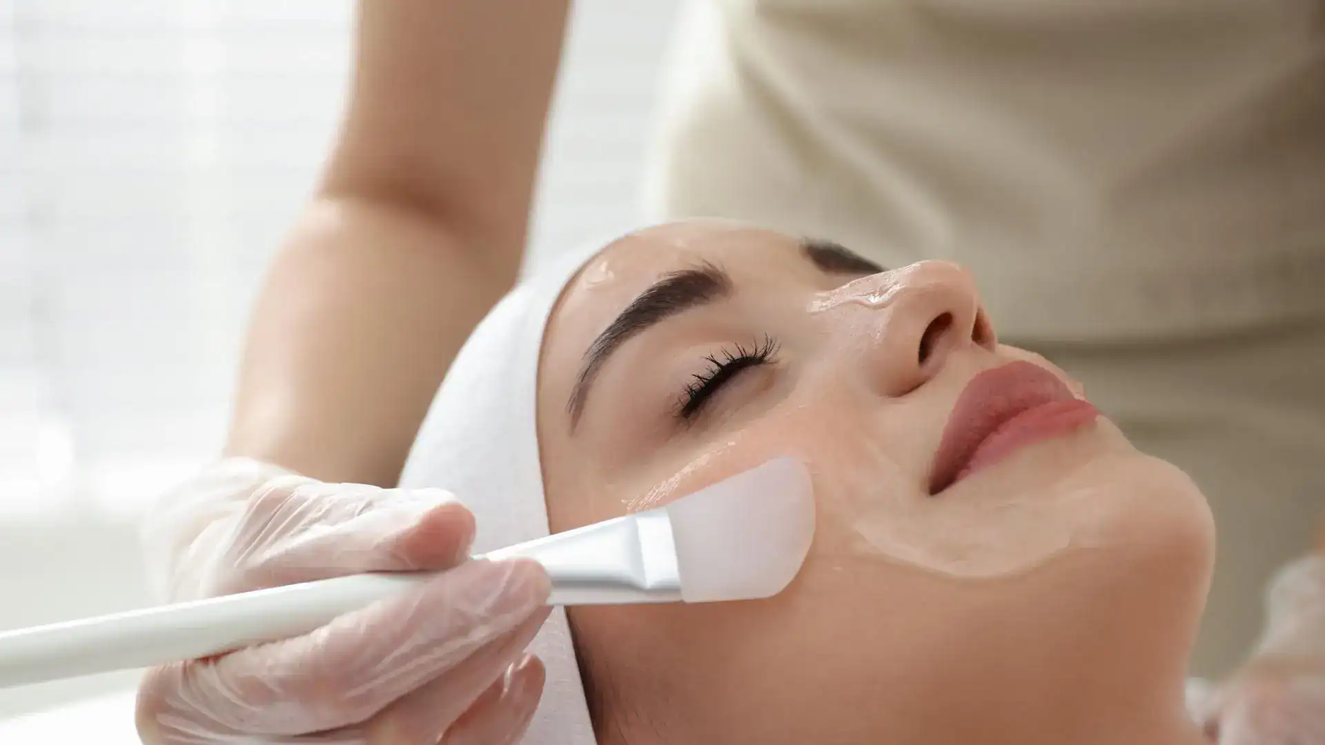 Chemical Peel for Dark Circles