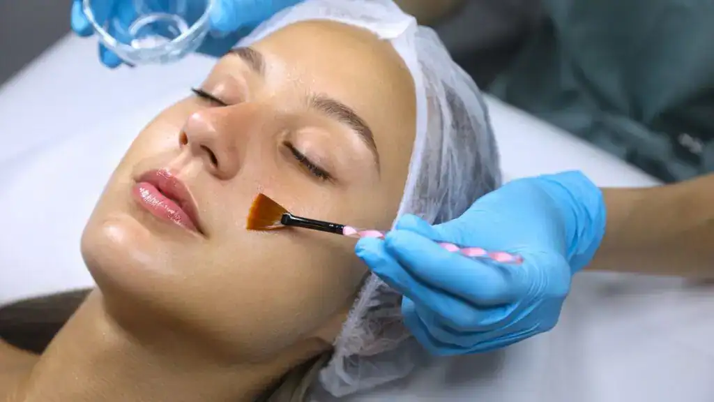 Chemical Peel for Skin Whitening