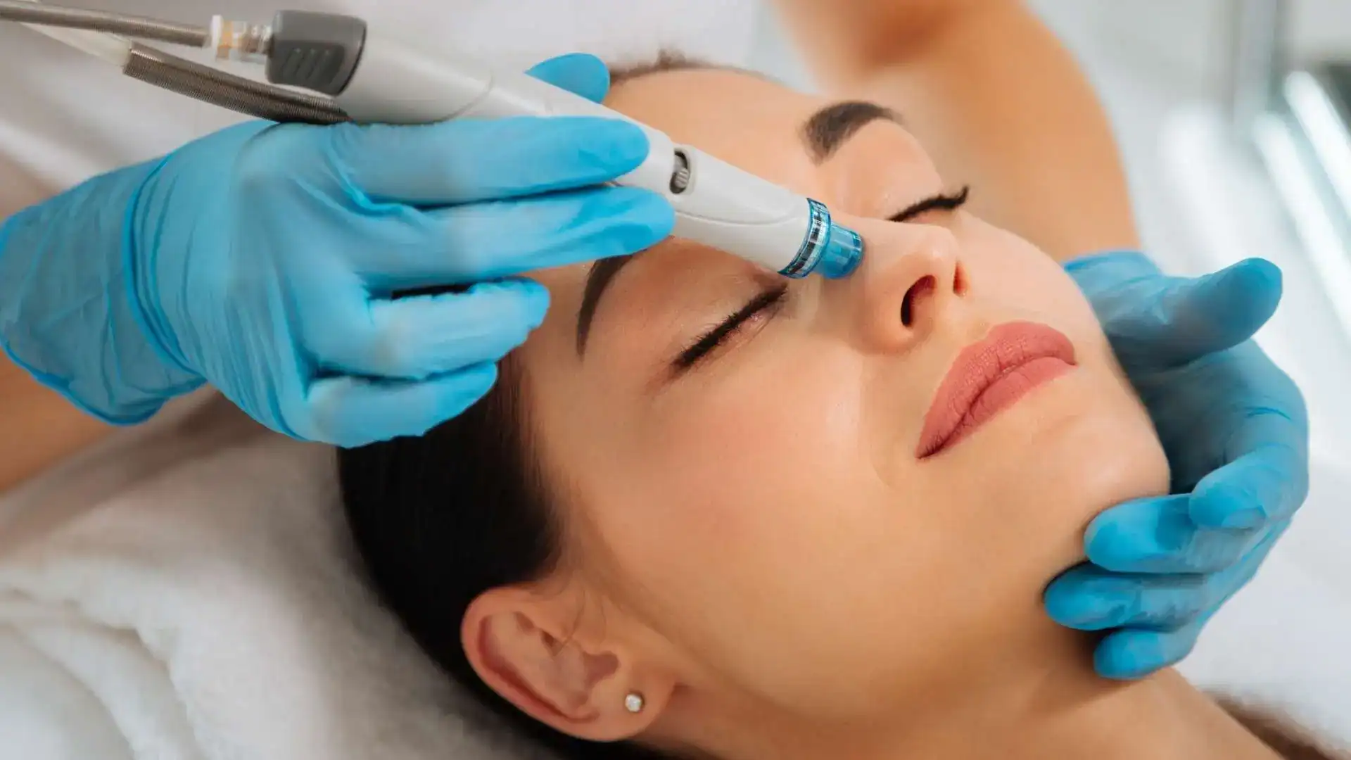 Hydrafacial Treatment Price in Chennai