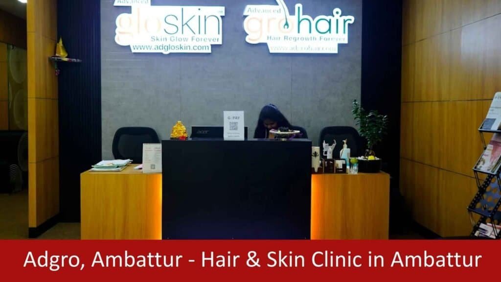 Skin Clinic in Ambattur