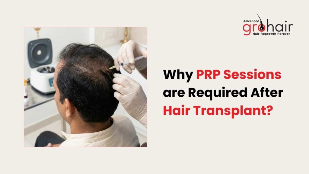 Why PRP Sessions are Required After Hair Transplant