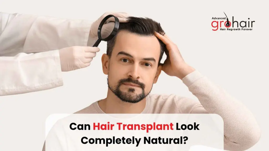 Can Hair Transplant Look Completely Natural
