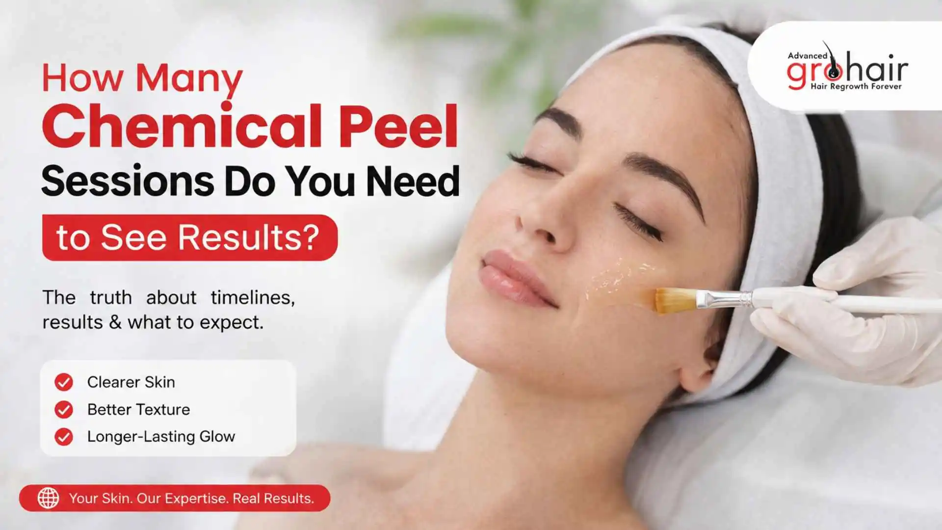 Progressive skin improvement after multiple chemical peel sessions for pigmentation and acne scars.