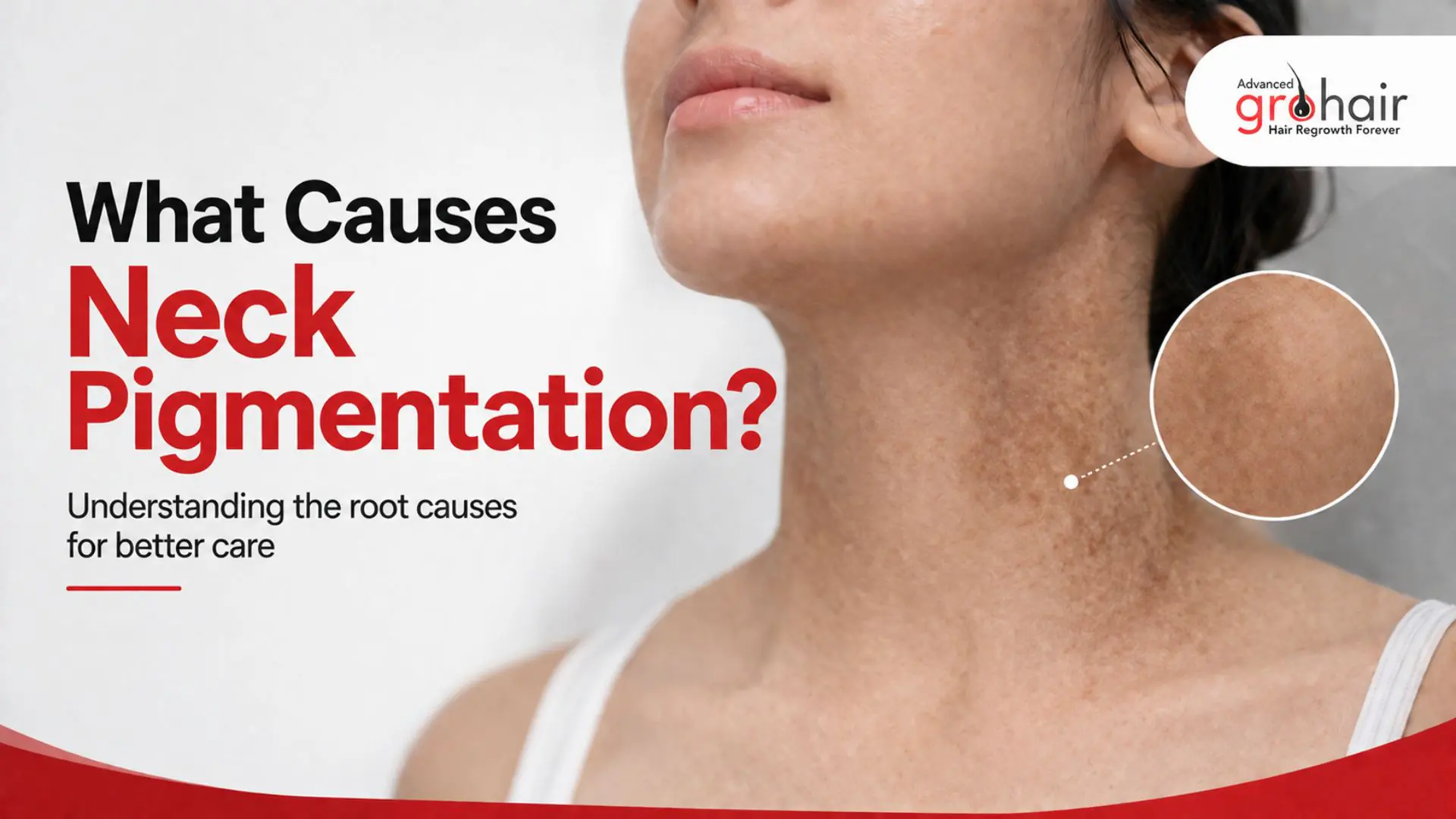 Neck Pigmentation
