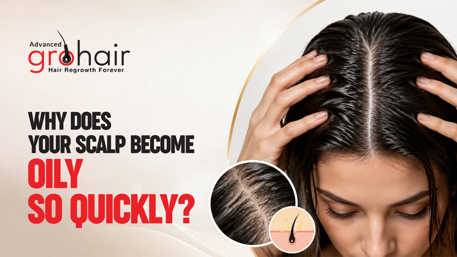 Why Does Your Scalp Become Oily So Quickly?