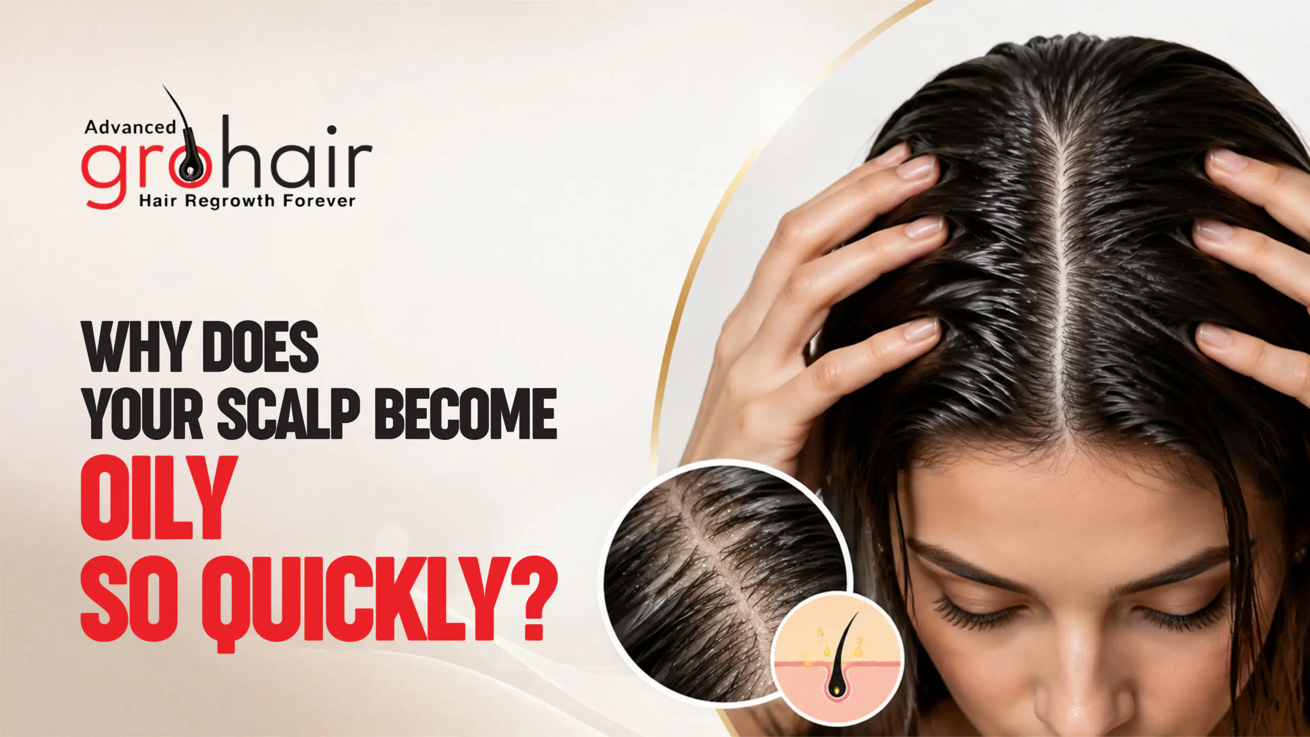 Why Does Your Scalp Become Oily So Quickly?