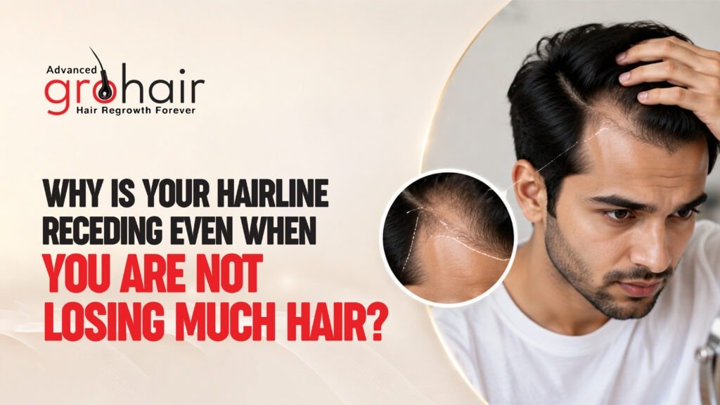 Why Is Your Hairline Receding Even When You Are Not Losing Much Hair?