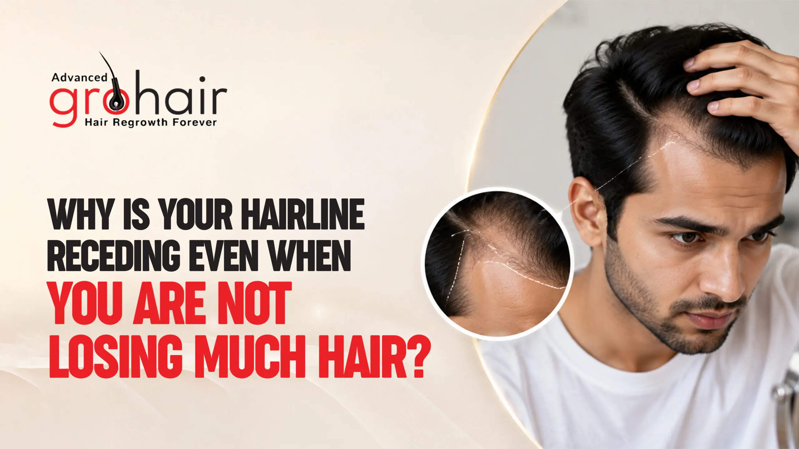 Why Is Your Hairline Receding Even When You Are Not Losing Much Hair?