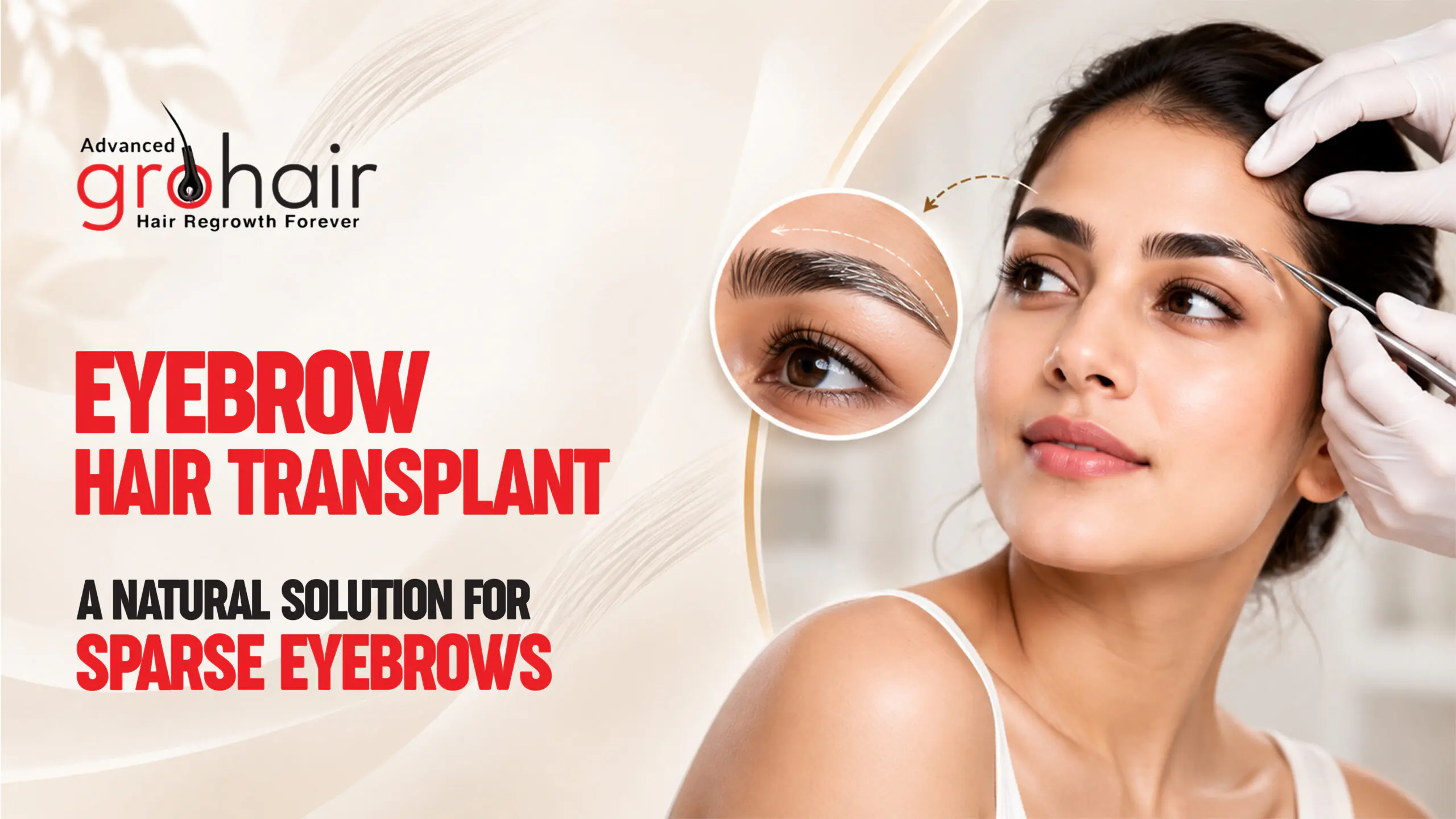Eyebrow Hair Transplant: A Natural Solution for Sparse Eyebrows