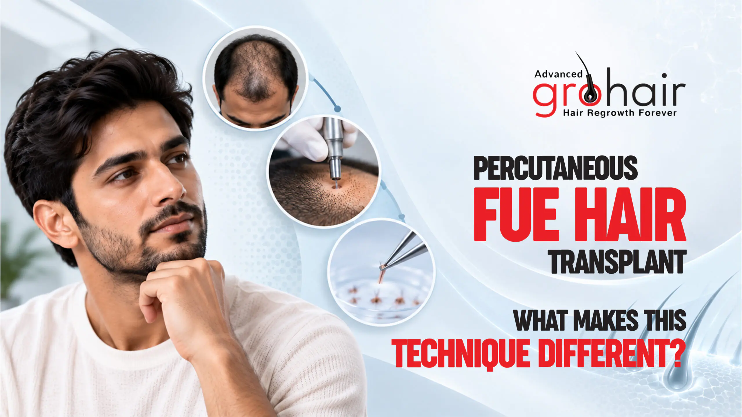 Percutaneous FUE Hair Transplant: What Makes This Technique Different?