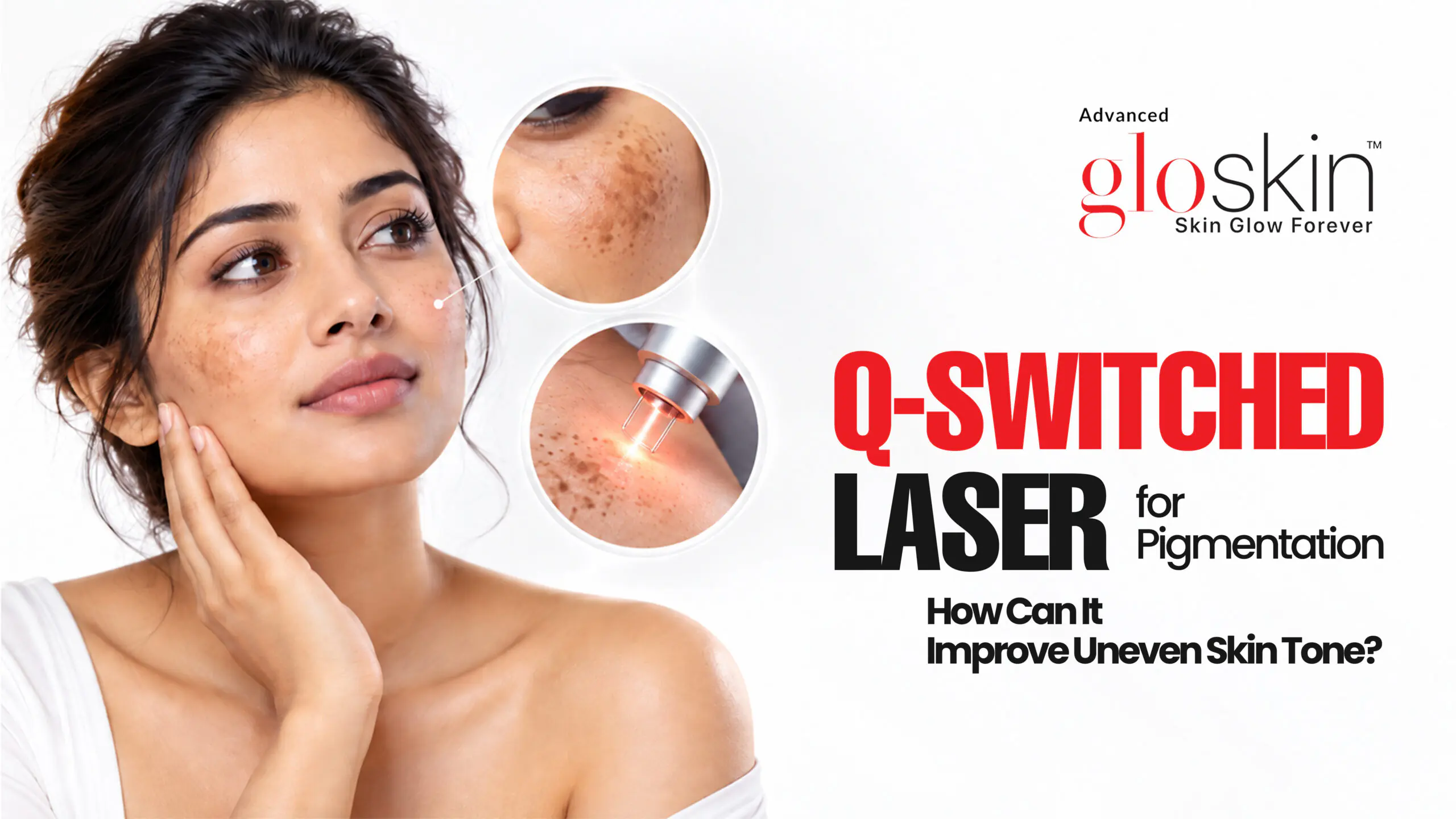 Q-Switched Laser for Pigmentation: How Can It Improve Uneven Skin Tone?